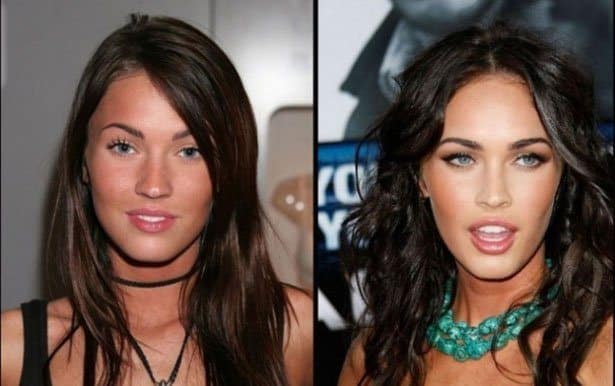 petroleum helikopter sti Relatively Shocking Photos of Celebrities Before And After Plastic Surgery