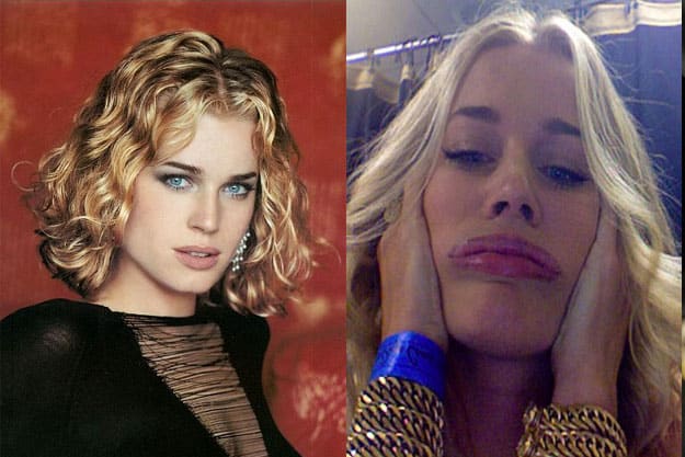SI-Swimsuit-Model-Ugly-Face