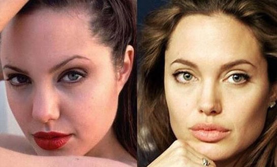 angelina jolie plastic surgery