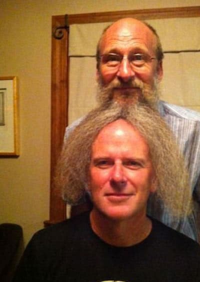bald-cure