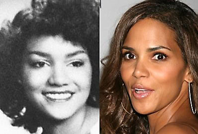 before after plastic surgery celebrities