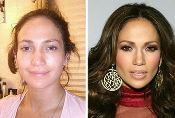 before after plastic surgery photos