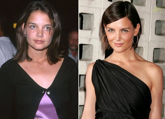 before after plastic surgery pictures