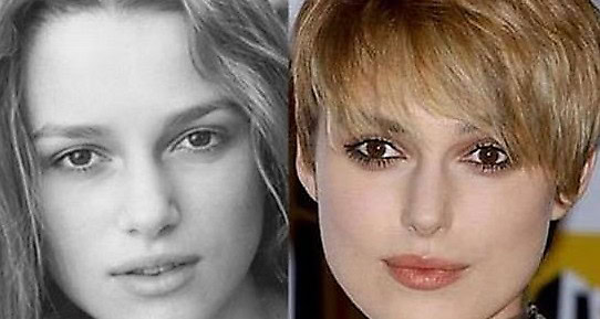 celeb before plastic surgery