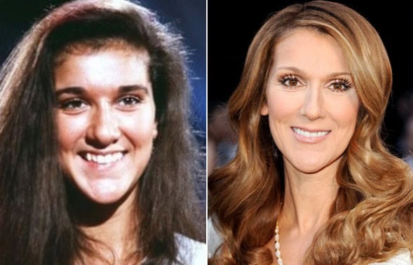 celebrities before plastic surgery