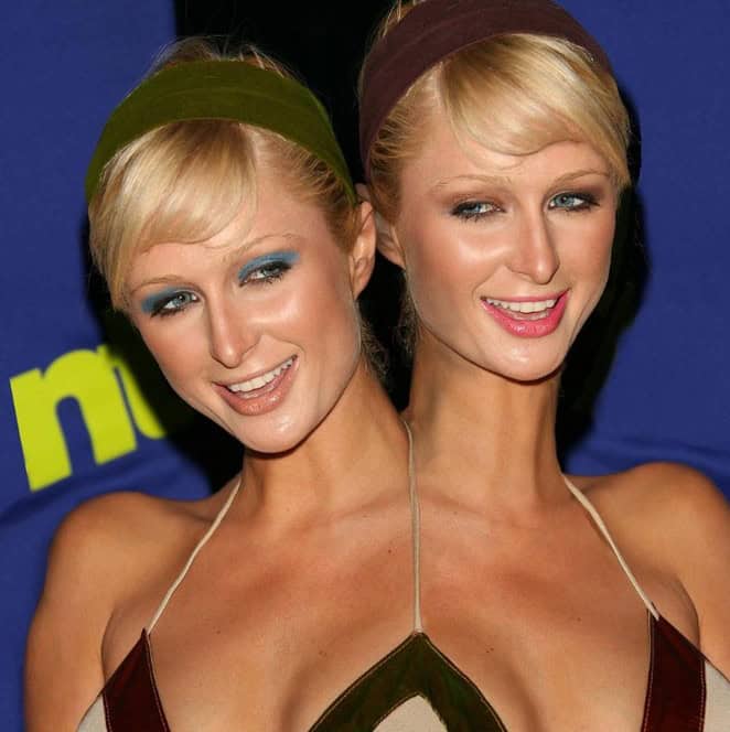 conjoined celebrities