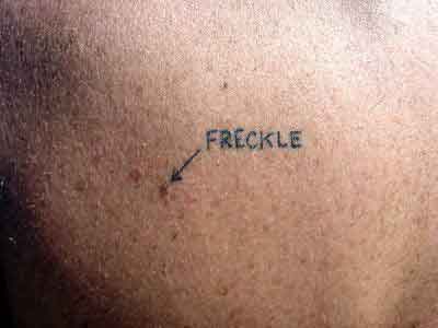 freckle-tattoo