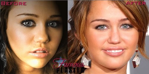 miley cyrus before after