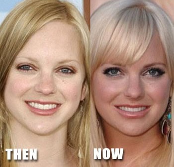 plastic surgery celebrity photos