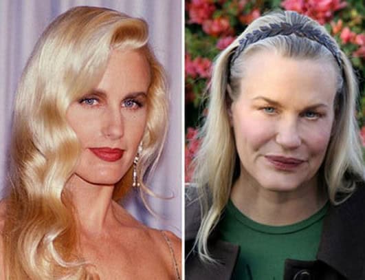 plastic surgery nightmares