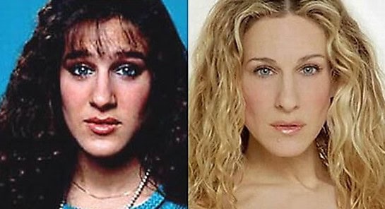 sarah jessica parker plastic surgery