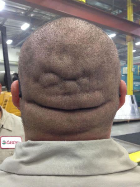 scalp-face