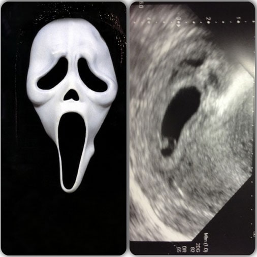 scream-fetus-sonogram