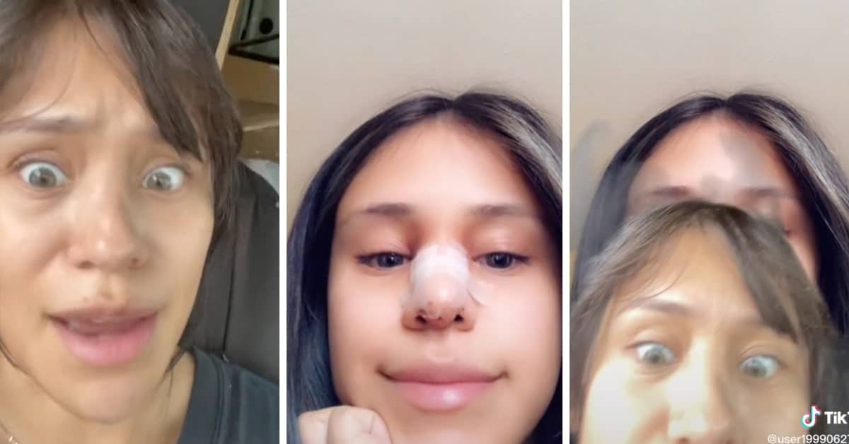 Woman Makes Cheating Boyfriend Pay For Her Nose Job—Then He Cheated Again.